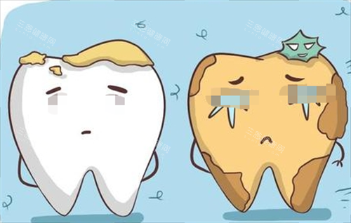 烂牙齿动画形象展示图