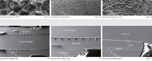 西泰克种植牙表面处理
