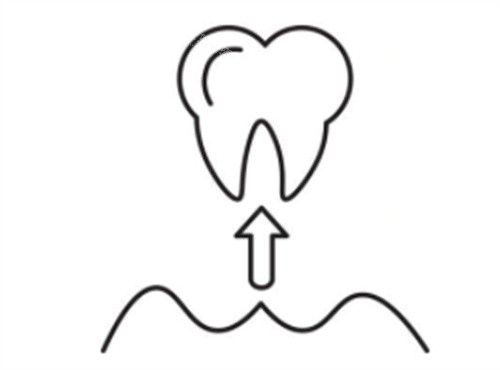 把牙齿拔出来 把牙齿拔出来