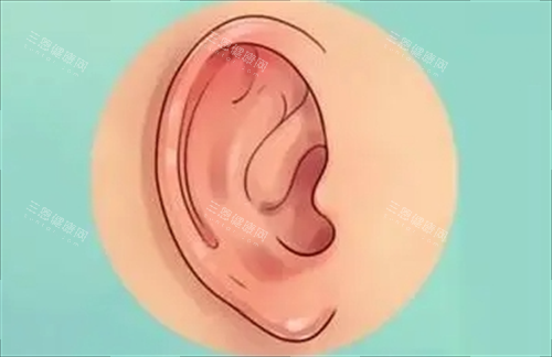 耳轮廓耳畸形动画展示 耳轮廓耳畸形动画展示