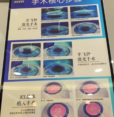 重庆佰视佳眼科怎么样？渝中区正规近视矫正机构|全飞秒/ICL技术靠谱|地址电话全公开
