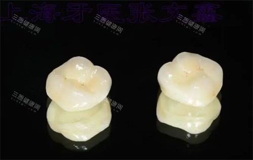 爱尔创全瓷牙外观 爱尔创全瓷牙外观