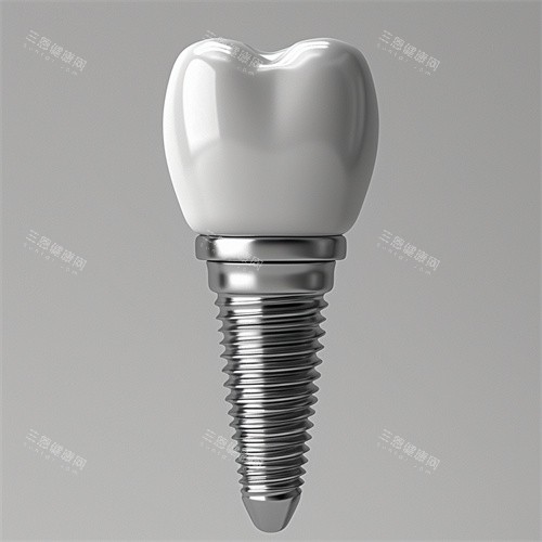种植牙植体和牙冠一提漫画示意图