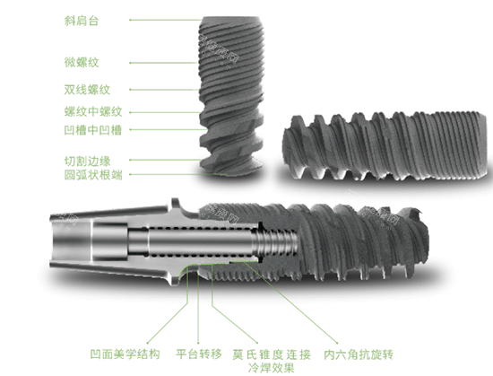 科惠种植牙种植体照片