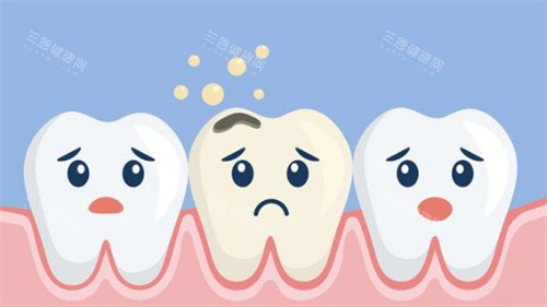 牙齿敏感 牙齿敏感