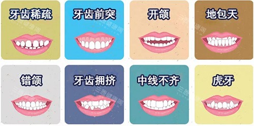 牙齿矫正不同适应症漫画图 牙齿矫正不同适应症漫画图