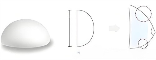 假体隆胸圆形 假体隆胸圆形