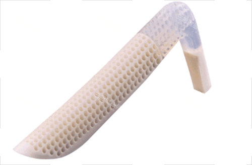 超体隆鼻照片图 超体隆鼻照片图