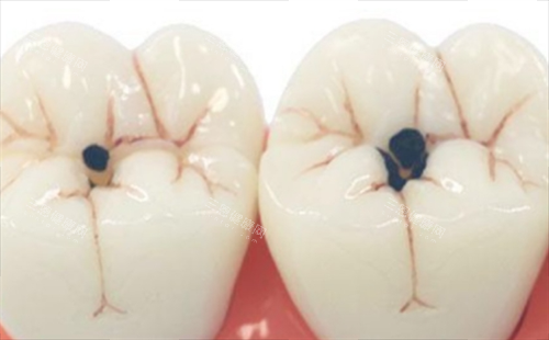 郫县优质牙科医院推荐：极美/包世洲/嘉仁/桔子口腔，成都看牙优选这几家