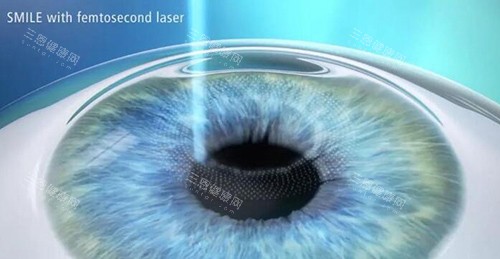 杭州友华普惠眼科：主打普惠眼健康，近视矫正、眼病筛查价格亲民，服务覆盖广