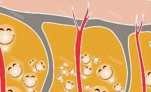 脂肪透视形象展示图 脂肪透视形象展示图