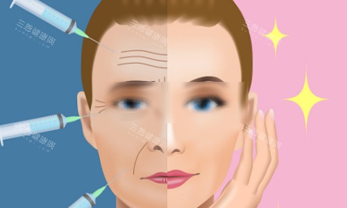 脂肪填充前后对比图 脂肪填充前后对比图