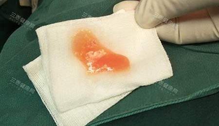 奥美定图片 奥美定图片