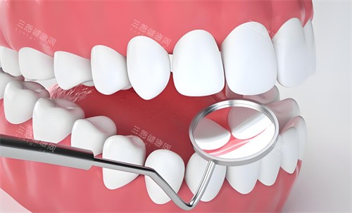 牙齿检查动画展示图 牙齿检查动画展示图
