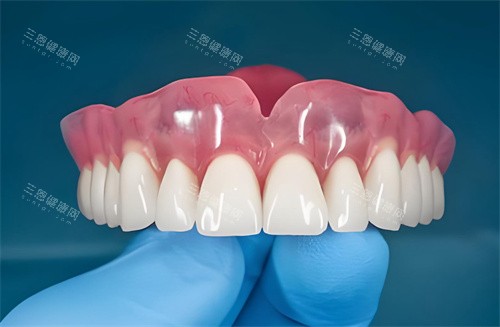 全口种植牙齿图片 全口种植牙齿图片