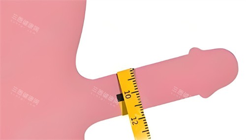 男性增大增粗手术 男性增大增粗手术