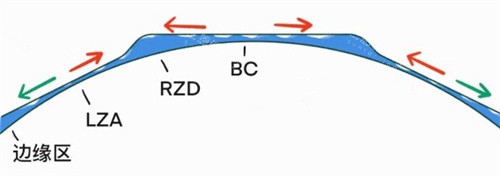 角膜塑形镜眼压变化 角膜塑形镜眼压变化