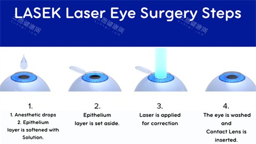 近视手术流程图 近视手术流程图