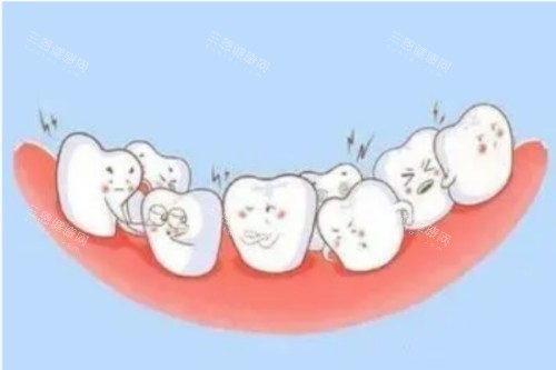 牙齿畸形卡通图 牙齿畸形卡通图