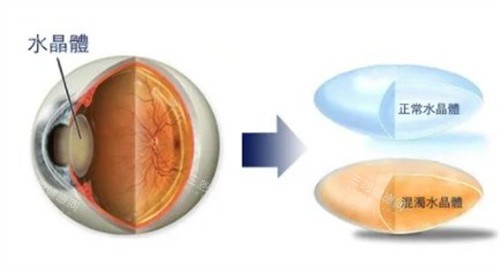 怀化市中医医院眼科怎么预约，微信、电话等多方式支持，分时段预约就诊有效！