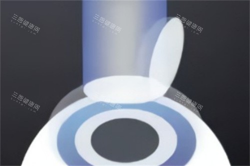 半飞秒准分子激光切削角膜