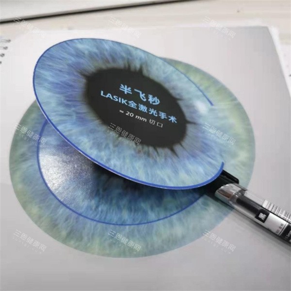 半飞秒Lasik激光手术 半飞秒Lasik激光手术