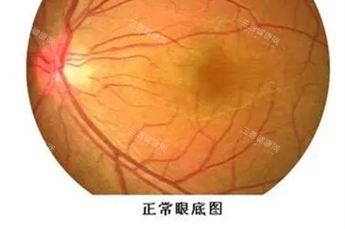 近视眼手术宣传图 近视眼手术宣传图