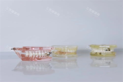 牙齿模型示意展示 牙齿模型示意展示