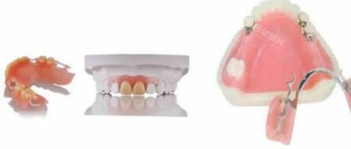 活动假牙佩戴过程示意图