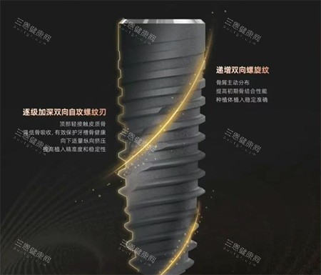 卡尔斯种植牙种植体螺纹照片