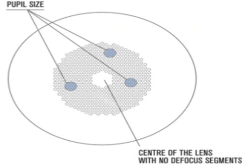 国产离焦镜片哪个牌子好？新知控/星视佳/思问/易百分/星乐视等牌子全攻略！