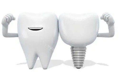种植牙和真牙模型示意图 种植牙和真牙模型示意图