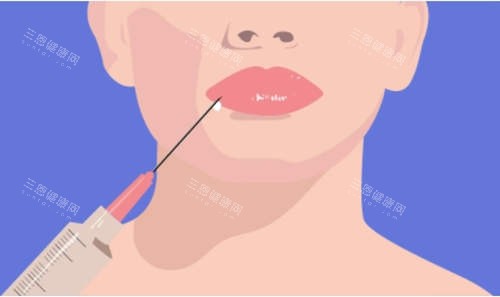 注射美容卡通图