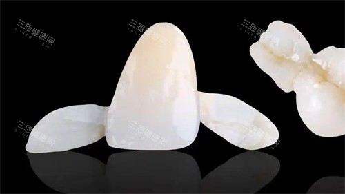 马里兰桥牙齿图片示意图