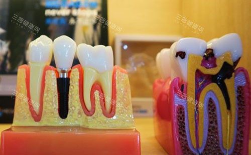 重庆铂恩口腔牙齿模型实拍图