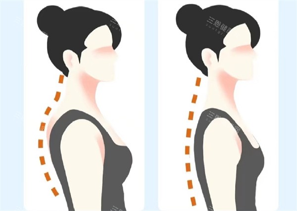 富贵包矫正手术