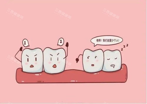 牙齿丢失漫画示意图