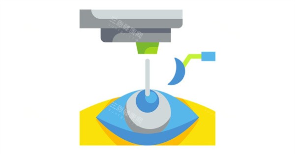 北京同仁医院眼科普通和特需门诊费用一样吗？差距实打实！关键项目价格不掺水分，预算早规划！