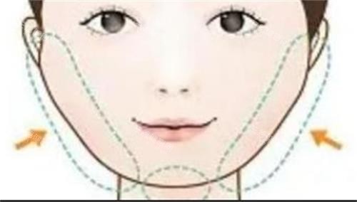 磨骨手术的部位