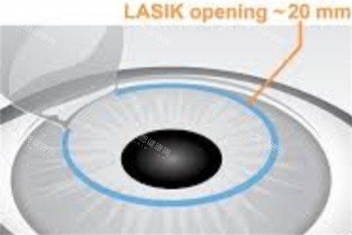 沧州爱眼医院眼科超靠谱！近视防控、白内障治疗结果佳，本地认可度高