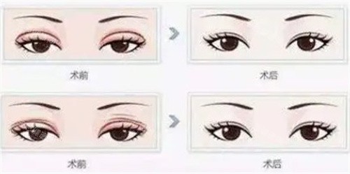 湖南吉首仁美医疗美容口碑评价超赞！患者反馈“服务暖技术好”，无隐形消费