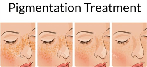 卓美整形医院正规吗？从合规操作、患者反馈及口碑，帮你确认是否放心选择！