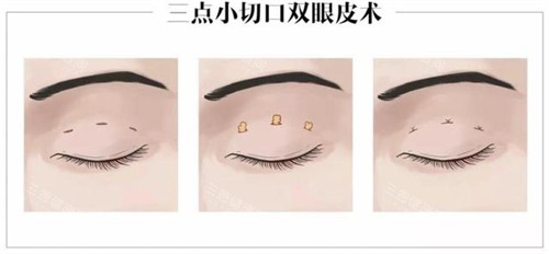 北京画美医院是正规医院！卫健委审批+诊疗规范，医美项目可靠有维持