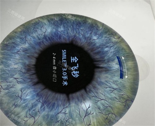 济南麦迪格眼科全飞秒手术介绍 济南麦迪格眼科全飞秒手术介绍