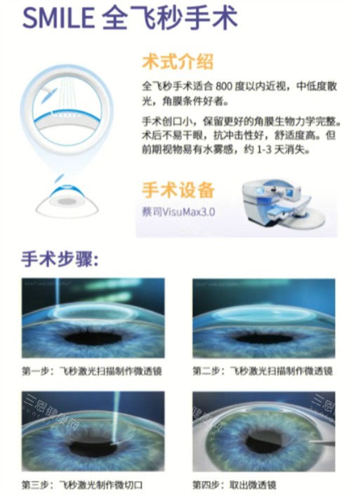 全飞秒近视手术术式介绍图解 全飞秒近视手术术式介绍图解