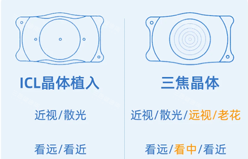 ICL和三焦晶体示意图