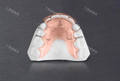 法兰克矫正器示意图