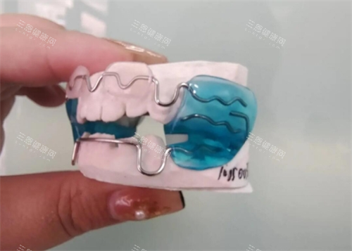 法兰克3矫正器实拍图片