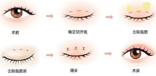 兰大二院整形科价格表大全：微整形+手术整形收费标准全公开