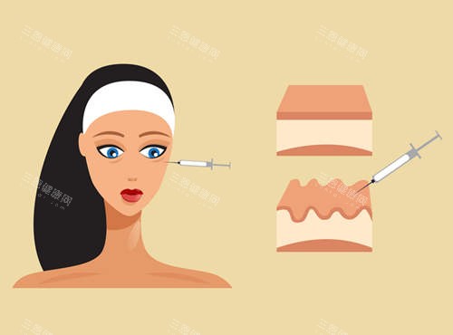 注射美容图示 注射美容图示